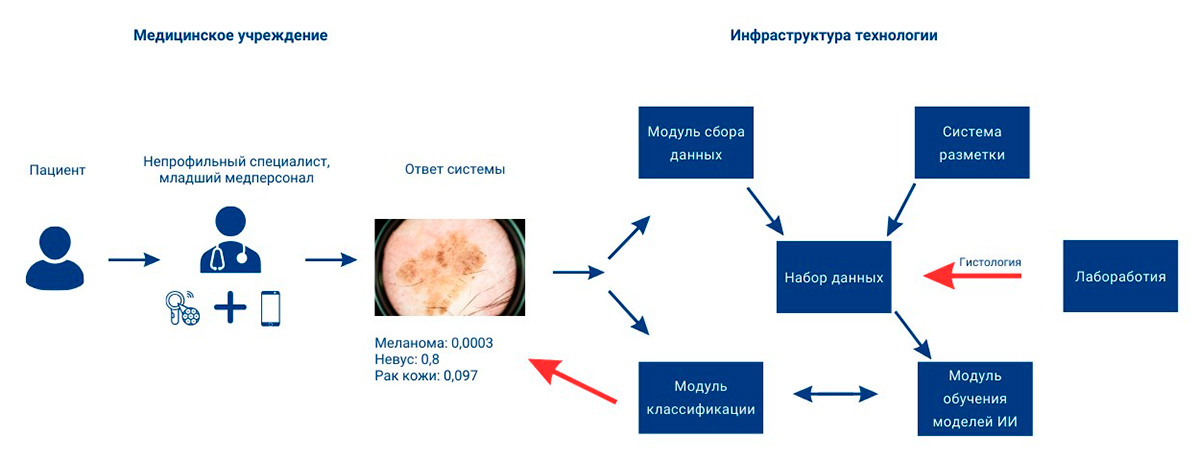 Melanoscope